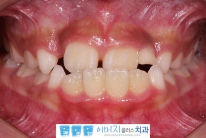 꾸미기_2