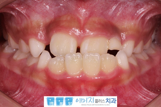 꾸미기_2