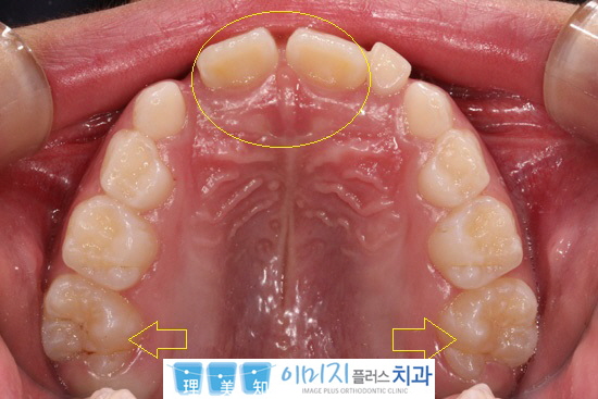꾸미기_3