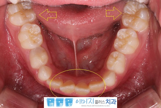 꾸미기_4