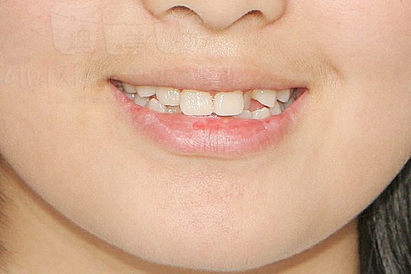 %ed%81%ac%ea%b8%b0%eb%b3%80%ed%99%98_%ec%a1%b0%ec%88%98%eb%b9%88-%ec%a0%84