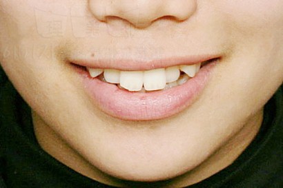 soo1