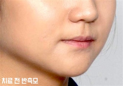 확장구외전
