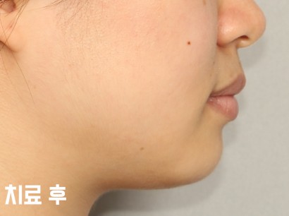 KBEOB
