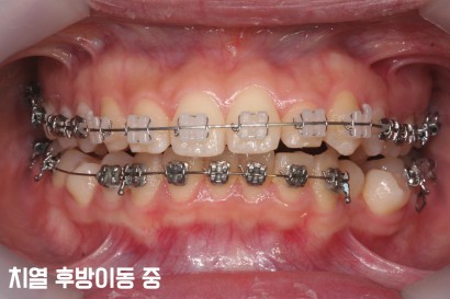 KBIO3
