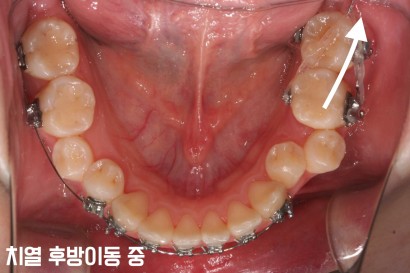 KBIO4