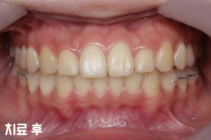 KBIO5