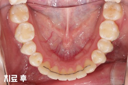 KBIO6